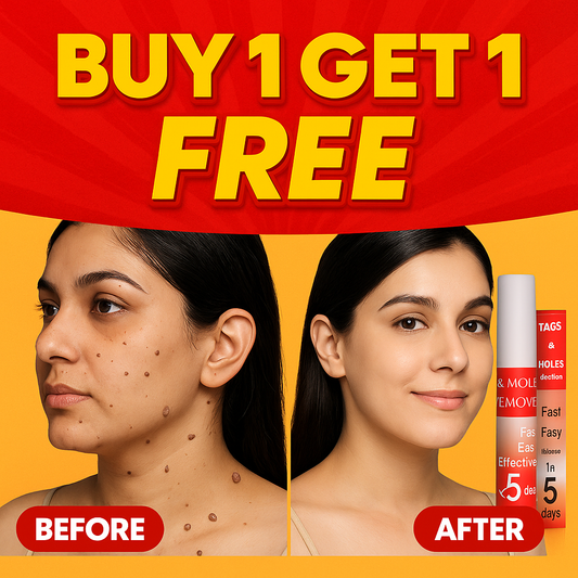 Warts & Tags Remover Pen - (Buy 1 Get 1 FREE🔥🔥)